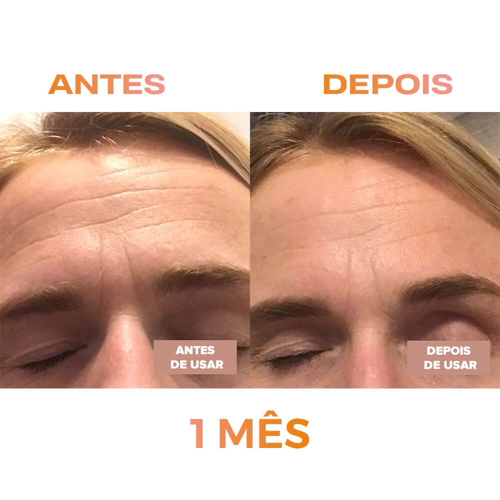renovei resultado_0003_6