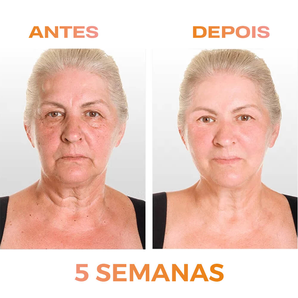renovei resultado_0007_2