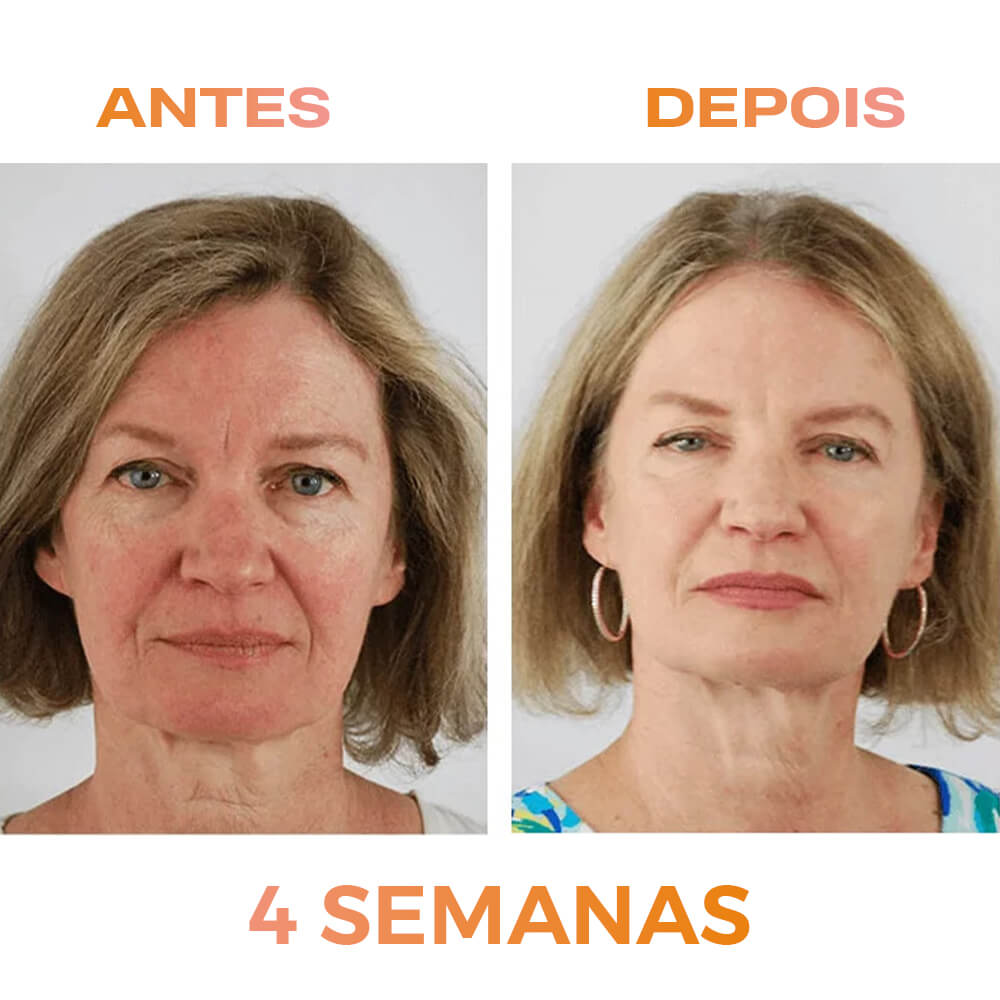 renovei resultado_0008_1